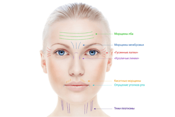 коррекции лобных морщин — Coolaser