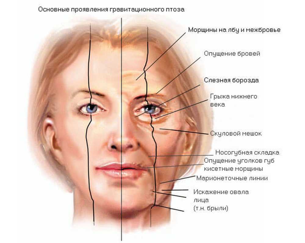 Лифтинг на дому: как в домашних условиях подтянуть кожу лица