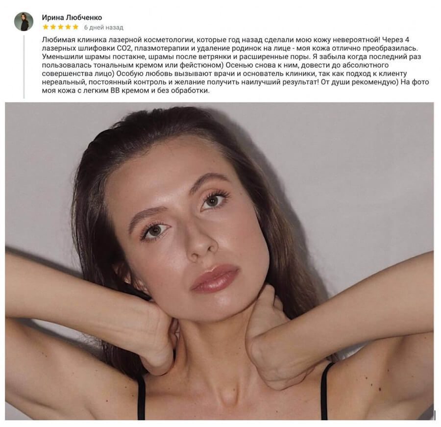 отзывы о лазерной шлифовке