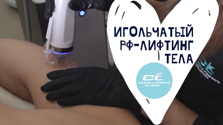 Игольчатый РФ тела