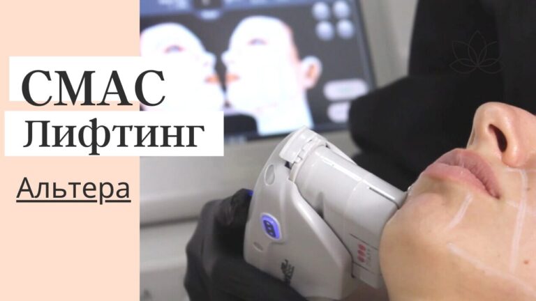 Смас лифтинг Альтера