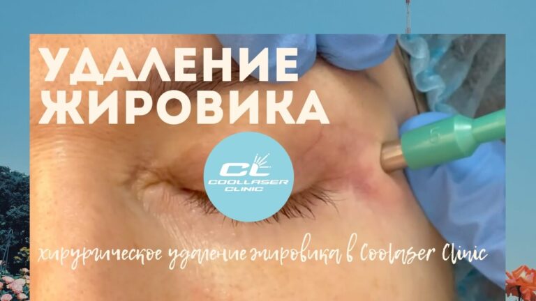 Удаление жмровика липомы