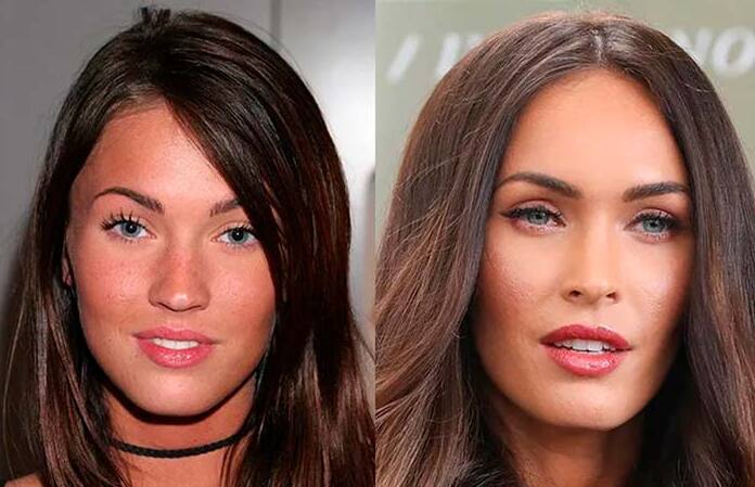 Megan Fox blepharoplasty Megan Fox
