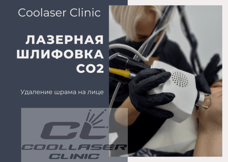 шлифовка шрама на лице