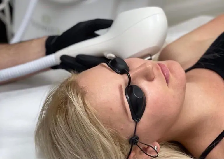 Удаление сосудов лазером фото