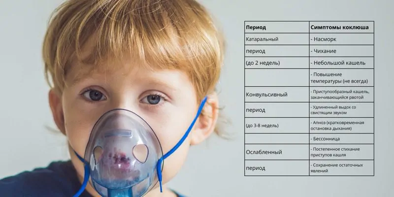 Коклюш Симптомы у взрослых и детей таблица