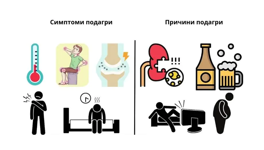 Симптомы подагры, причины подагры Схема / Симптоми подагри, причини подагри Схема