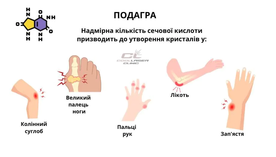Области поражения. Рисунок основных частей тела / Області ураження. Малюнок основних частин тіла